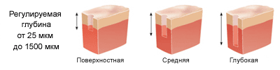 ablation