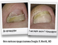 clearsense-email-clinical-photos