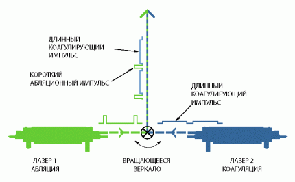 dual-lasers