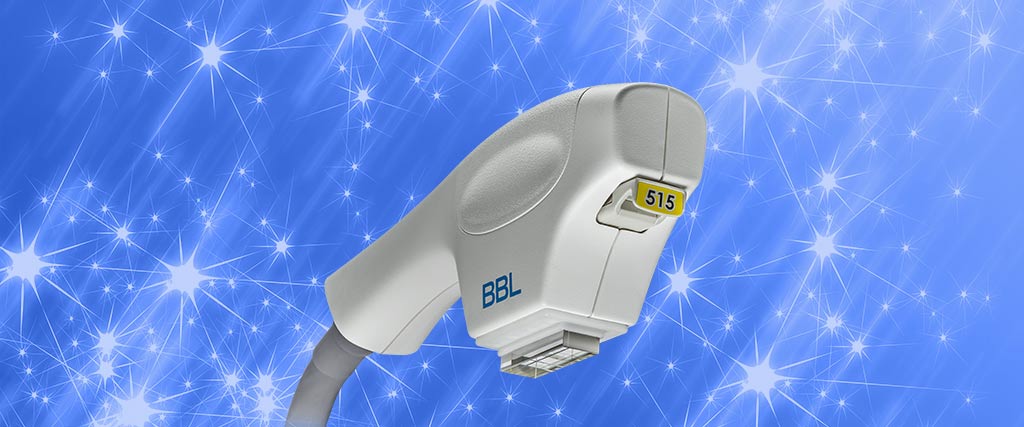 BBL - система широкополосного импульсного света, аппарат IPL
